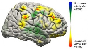 BCI-brain-image-300x168